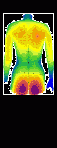 Postire 3D Podologie Reiland